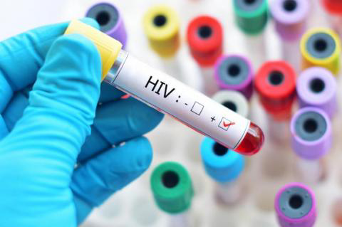 HIV-om zaražena 221 osoba, za godinu preminule dvije