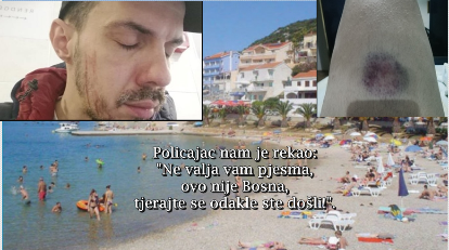 Bojan Tomović, alijas Ammar Moštrokol napadnut: Pjevača koji slavi i veliča Mila Đukanovića pretukli u Neumu!