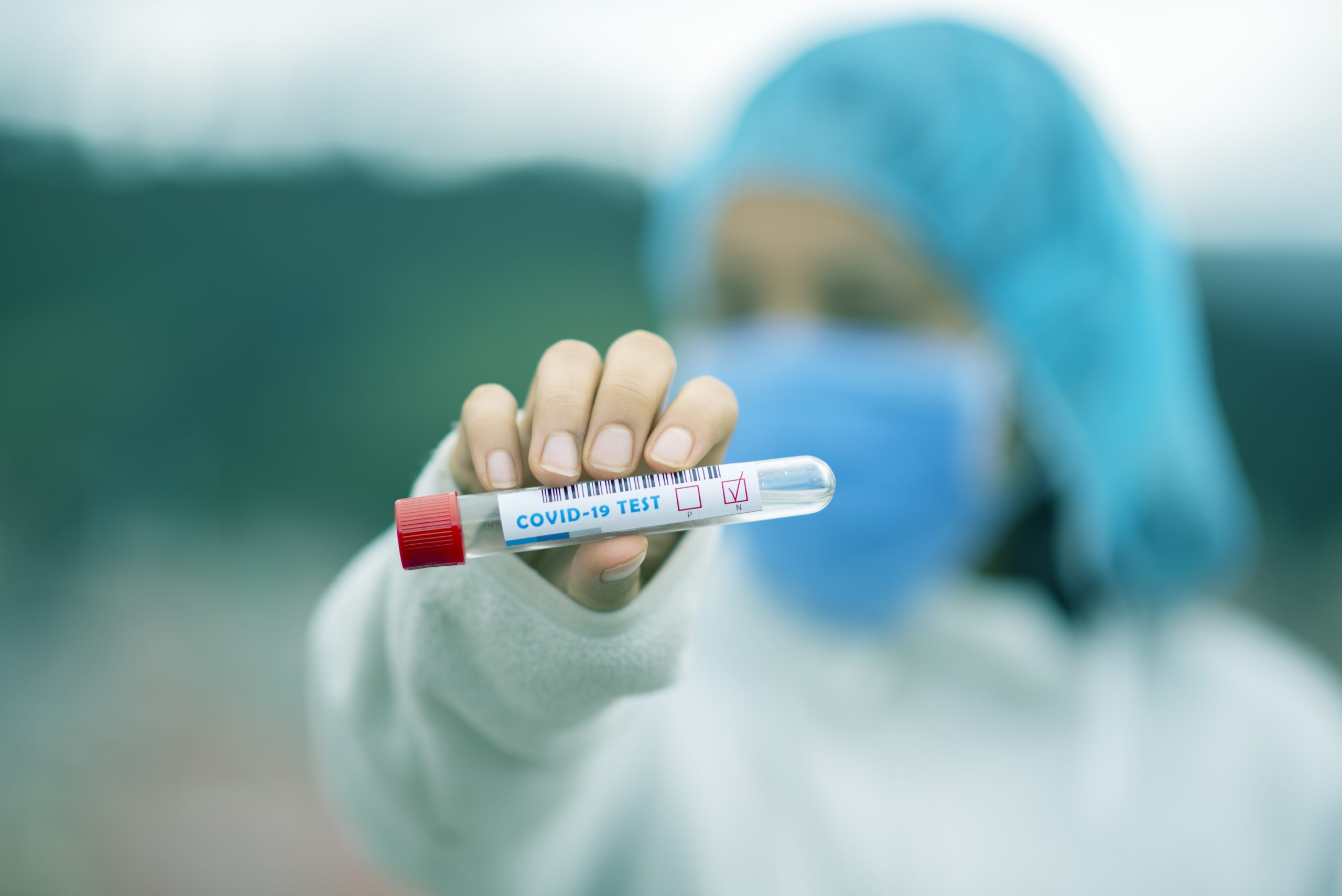 Virus i dalje ne jenjava: Od početka korone preminulo 725 građana Crne Gore!