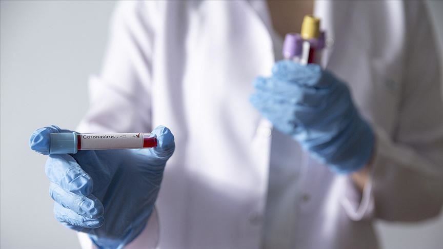 U Srbiji preminule 22 osobe, još 1.393 nova slučaja koronavirusa