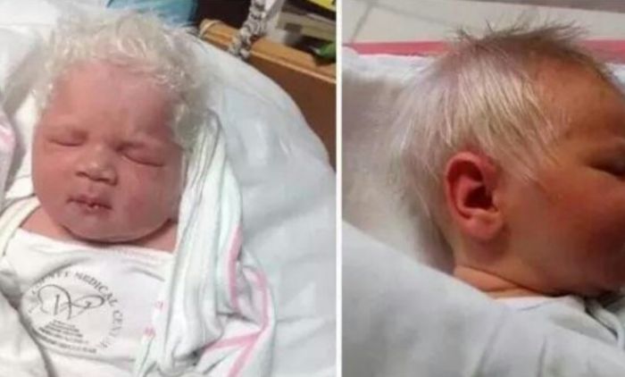 Rijetkost: Beba Bence ima srebrnu kosu, ali nije albino (VIDEO)