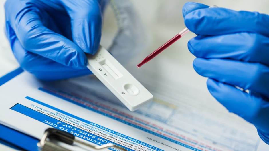 PCR test iz Crne Gore priznat u 162 države svijeta
