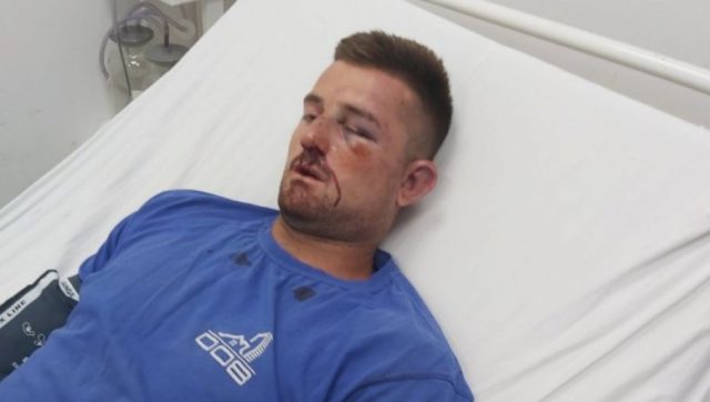 Novi napad na Srbe na Kosmetu: Tri Albanca PRETUKLA mladića dok je čuvao stoku!