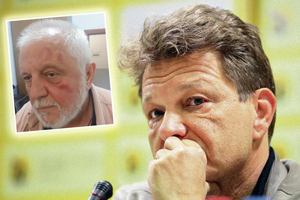 Priveden glumac Dragan Bjelogrlić: Osumnjičen da je pretukao reditelja Predraga Antonijevića