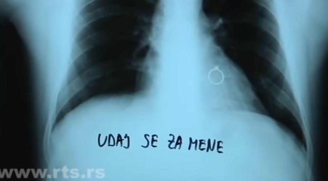 Uz snimak pluća i prsten dovitljivi Gabrijel zaprosio doktorku