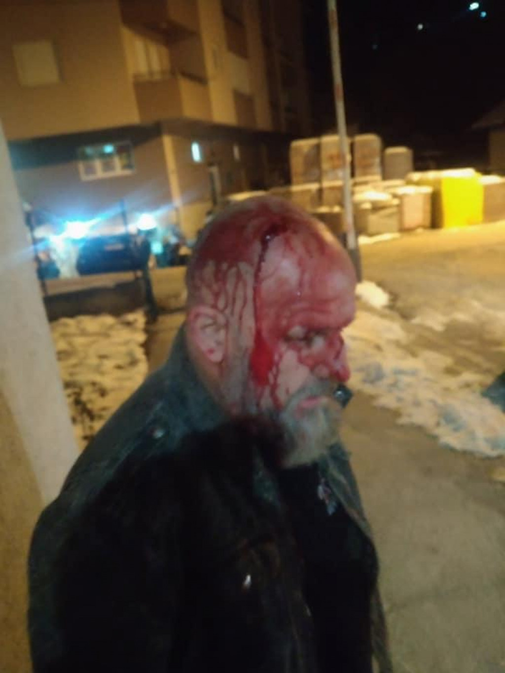 Maskirane osobe napale člana Demokrata u Petnjici: Oni tvrde da je napad politički motivisan