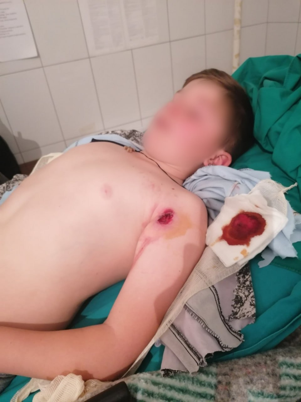 Direktor Doma zdravlja u Štrpcu: Klasičan teroristički akt, ovako nešto nije se desilo još od rata!