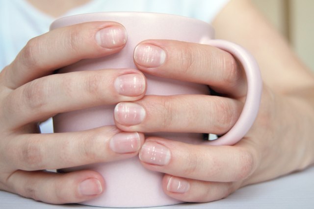 Nedostatak vitamina može biti uzrok problema sa kožom, kosom i noktima