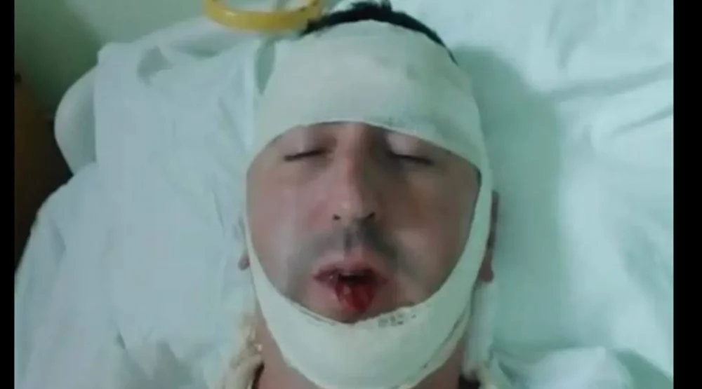 ODT Nikšić odredilo zadržavanje osumnjičenima za napad na Boška Pavićevića