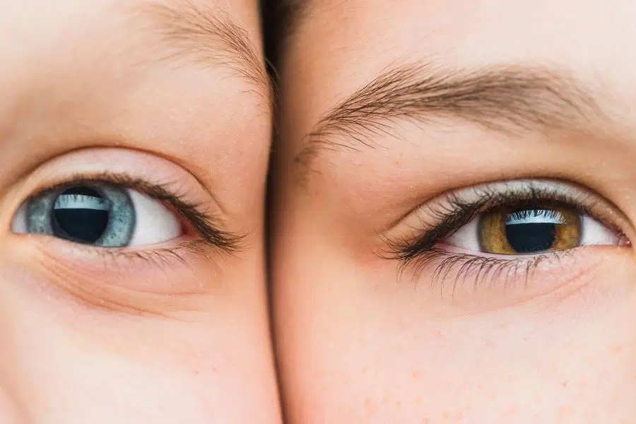 Vještačka inteligencija prepoznaje autizam na osnovu fotografije oka
