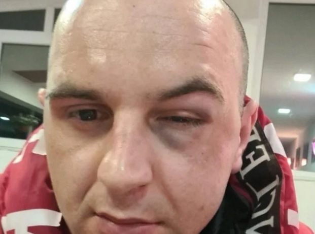 Tiktoker tvrdi da je pretučen u Plavu