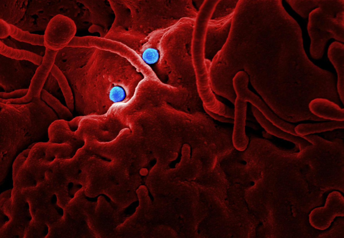 virus pod mikroskopom