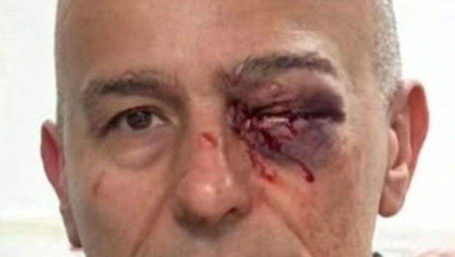 Beograd: Sinoć došlo do haosa ispred RTS-a, napadnuti pripadnici Žandarmerije, jednom teško povrijeđeno oko!