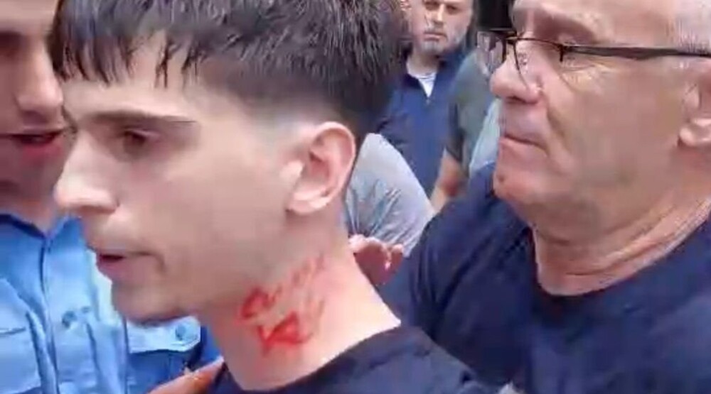 Vučević o snimku napada tzv kosovske policije na srpskog maturanta: Slika i naličje lažne države, tražim hitnu reakciju!