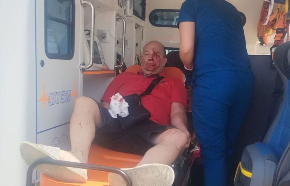 Svađa zbog parkinga zamalo završila kobno: Izudarao vatrogasca kašikom od bagera, razbio mu zube i glavu!
