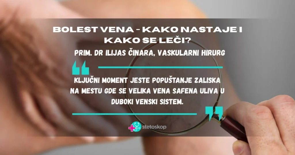 Bolest vena – kako nastaje i kako se liječi?