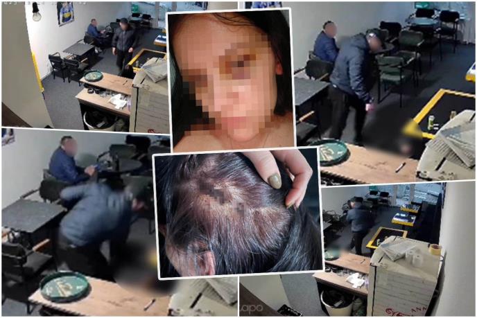 „NAPADAO JE I DRUGE ŽENE, SVI GA SE PLAŠE“ Nema kraja hororu za djevojku prebijenu u Beranama – Noć uoči suđenja zaprijetili joj jezivim riječima: „Pazi šta ćeš reći“
