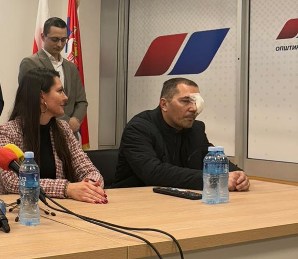 Napadnut potpredsjednik SNS-a Aranđelovac: Udaren pesnicom, polomljene mu naočare i ima staklo u oku!