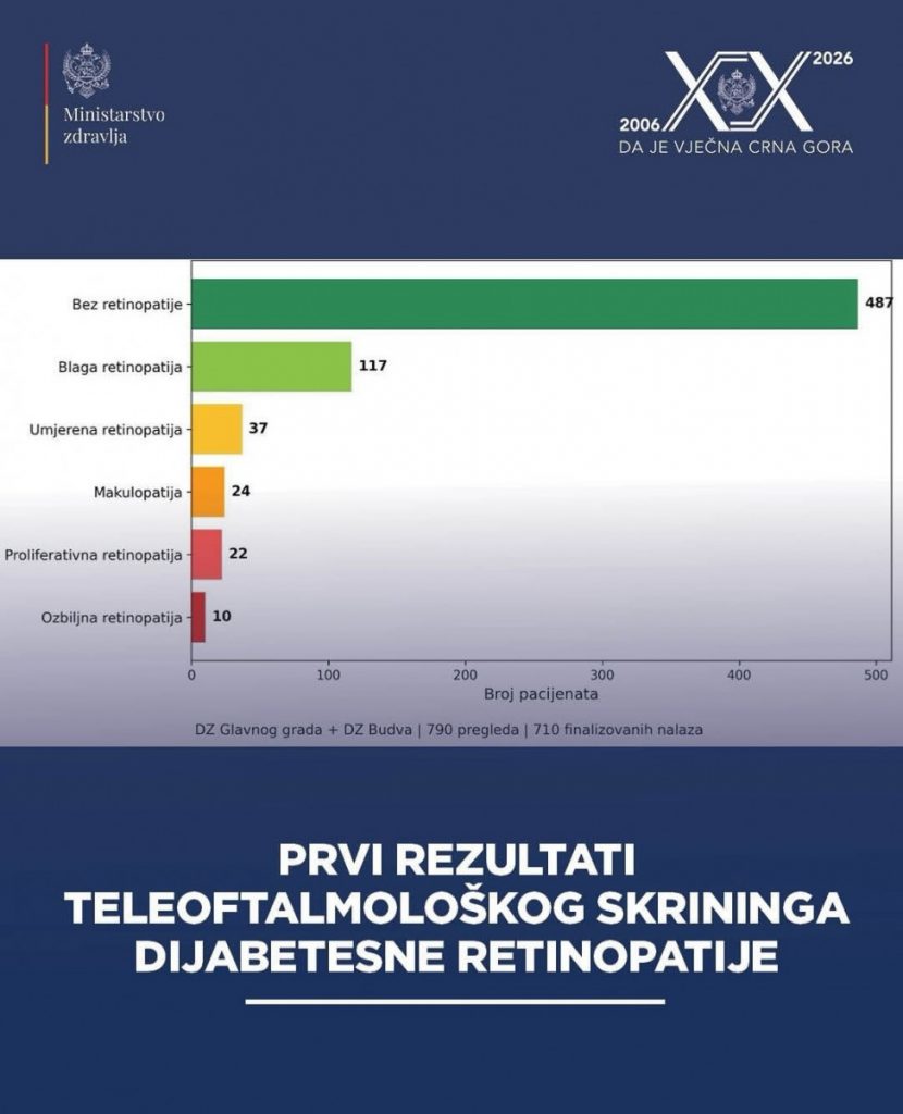 Dom zdravlja Glavnog grada: Kod 200 pacijenata otkrivene promjene na mrežnjači povezane sa dijabetesom