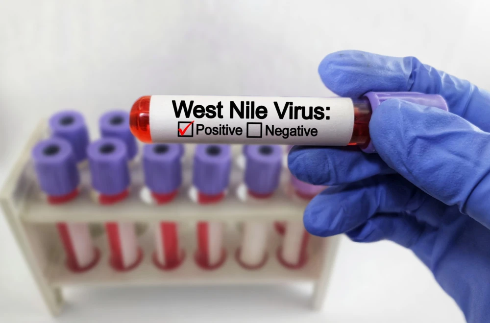 Alarm u Grčkoj: Virus Zapadnog Nila se širi, ovdje je najveće žarište do sada